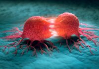 La hausse des cas de cancer dans la région du Sud d’Haïti, inquiète