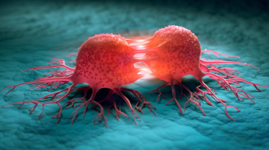 La hausse des cas de cancer dans la région du Sud d’Haïti, inquiète